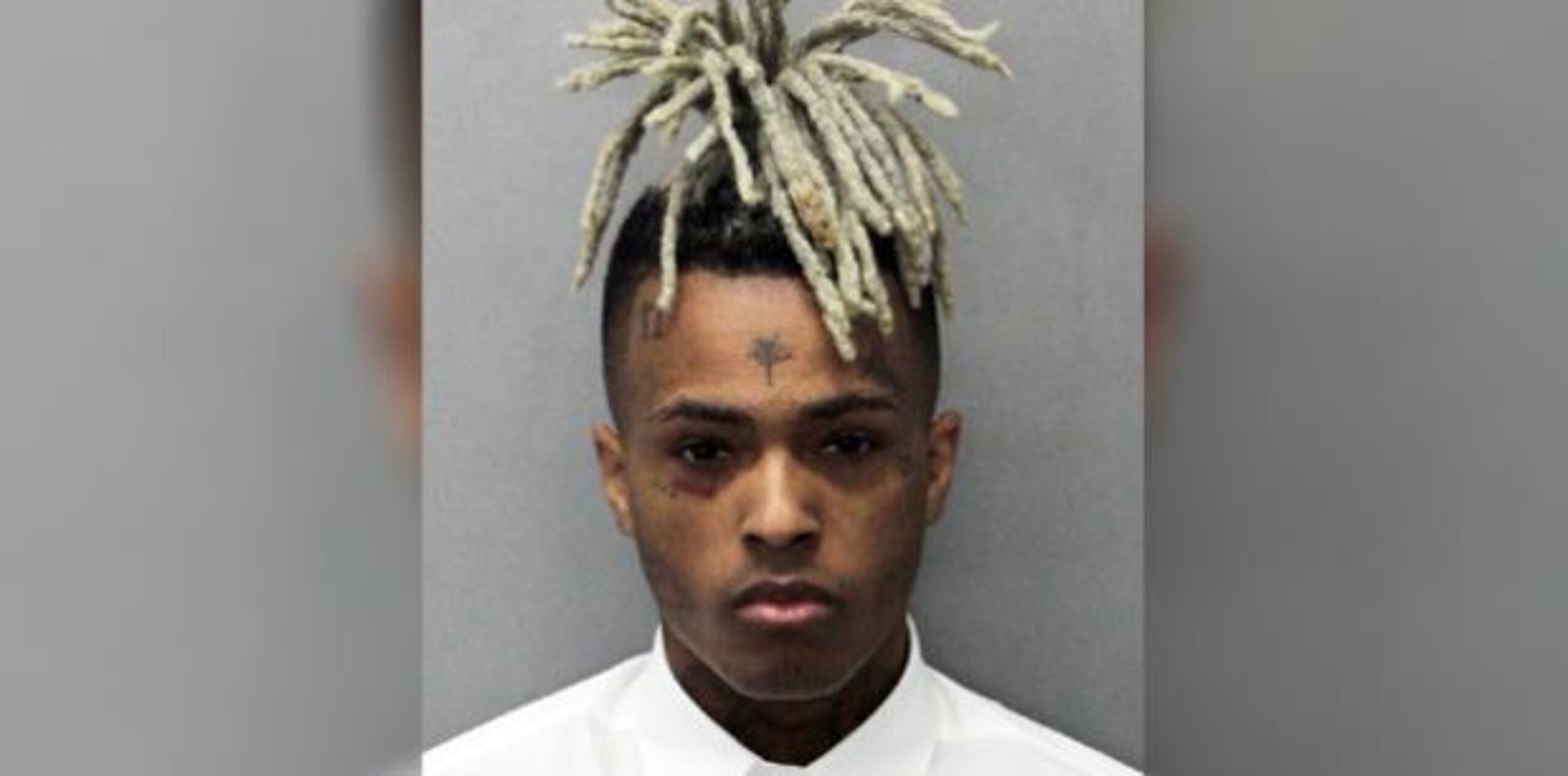 XXXTentacion tenía 20 años. (Departamento de Corrección y Rehabilitación de Miami-Dade vía AP)