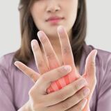 En desventaja las mujeres con la artritis reumatoidea
