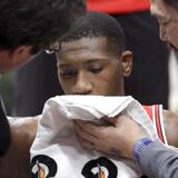 Kris Dunn se rompe dos dientes tras gran jugada