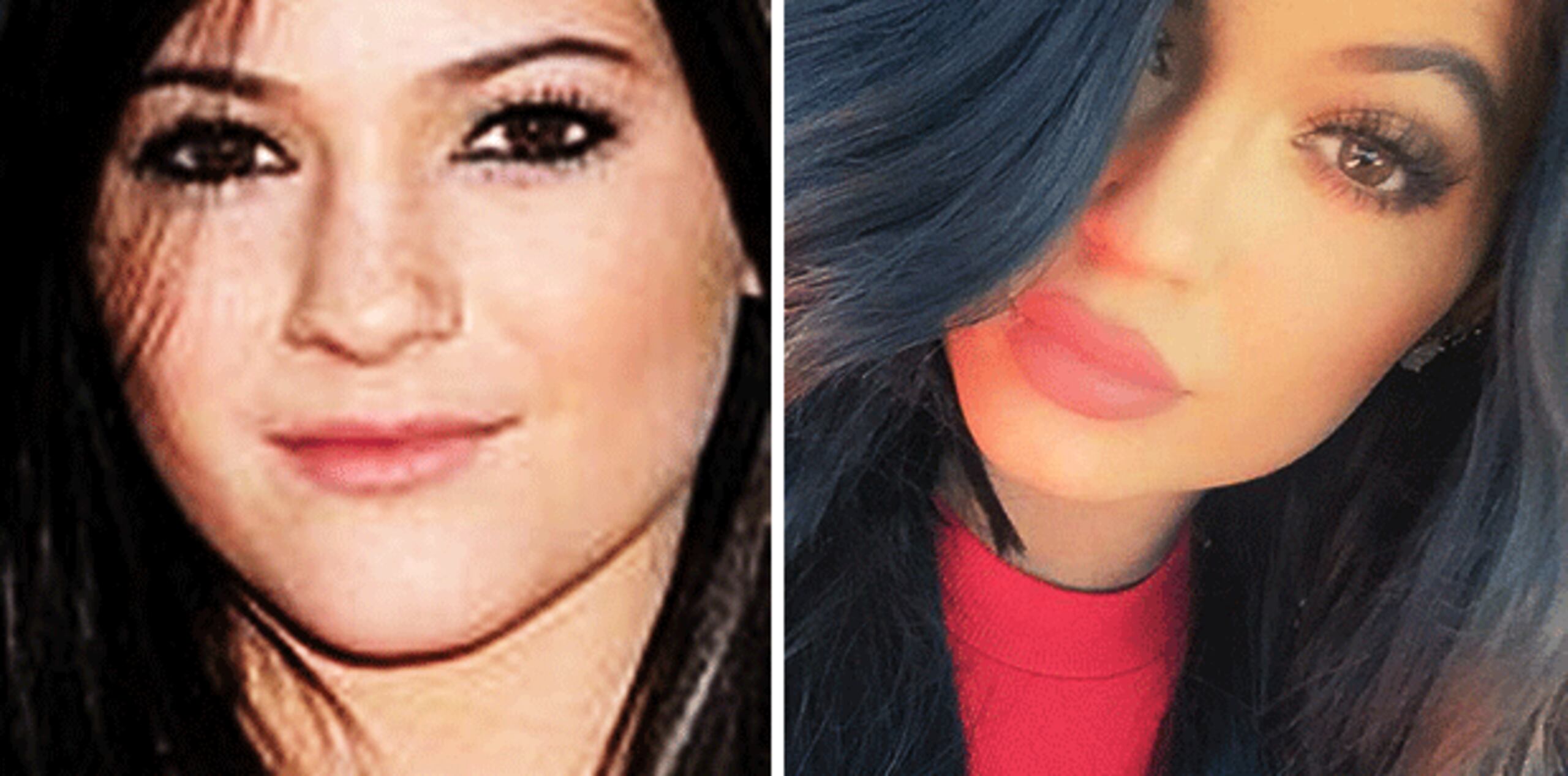 Si bien es cierto que Khloé tiró al medio a su hermana, no ha quedado claro si Kylie se sometió a una cirugía, inyección o tratamiento no invasivo para aumentar el tamaño de sus labios. (Archivo)