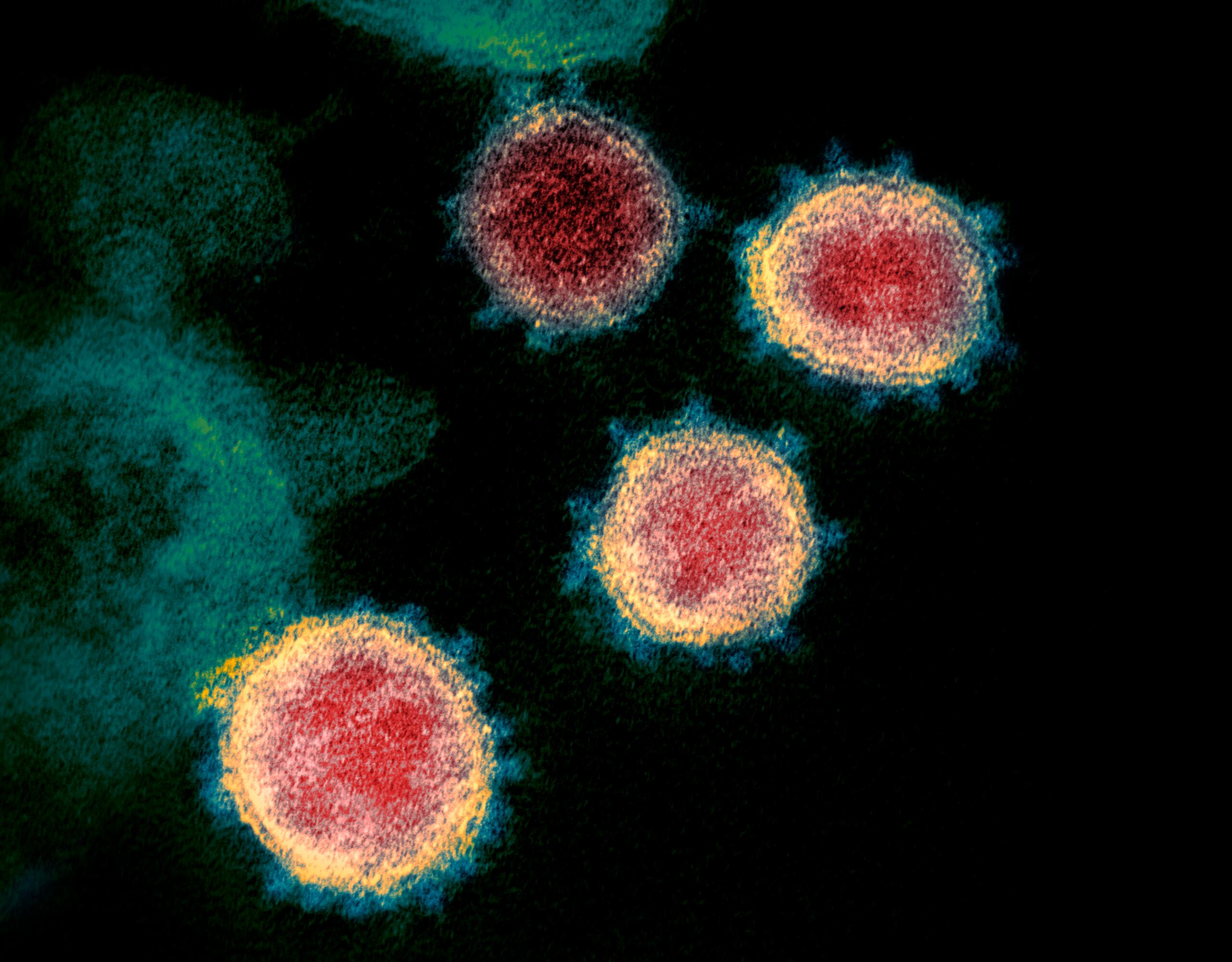 Esta imagen de microscopio electrónico muestra el virus que causa la enfermedad COVID-19.