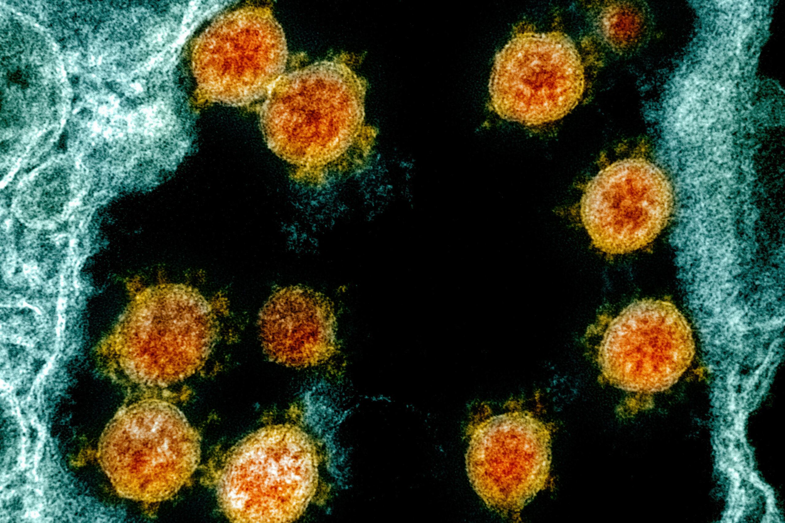 Partículas del coronavirus SARS-CoV-2 aisladas de un paciente.