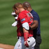 Justin Turner recibe 16 puntos tras recibir pelotazo en la cara