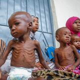 Cientos de personas mueren de hambre en Somalia 