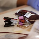 Solicitan donantes de sangre para agente herido de bala 