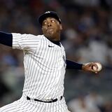 Aroldis Chapman se hizo un tatuaje, se le infectó y perderá dos semanas