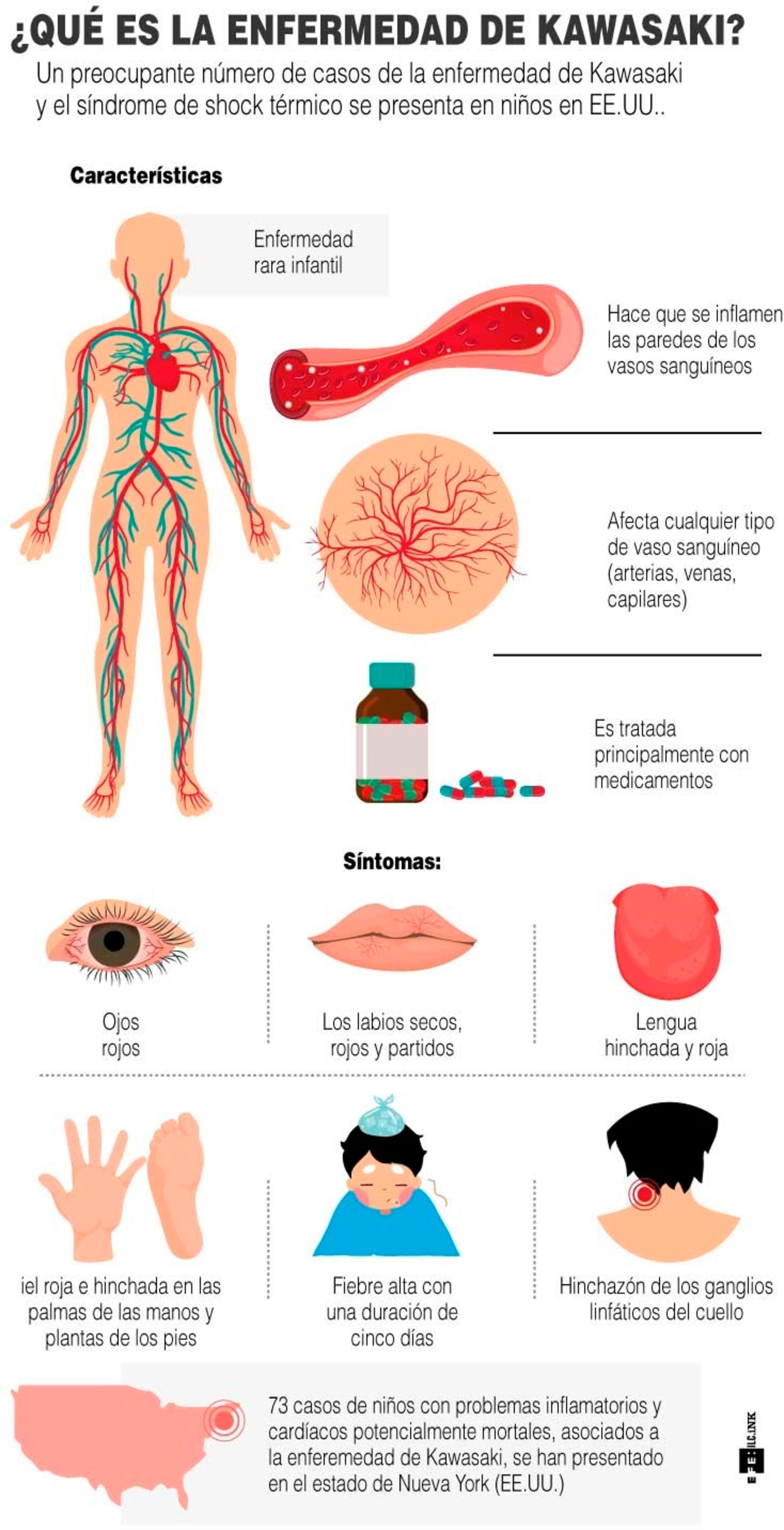 Un preocupante número de casos de la enfermedad de Kawasaki y el síndrome de shock térmico se presenta en niños en EEUU. EFE
