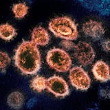 Estudio concluye que la exposición a otros coronavirus  protege ante el COVID-19